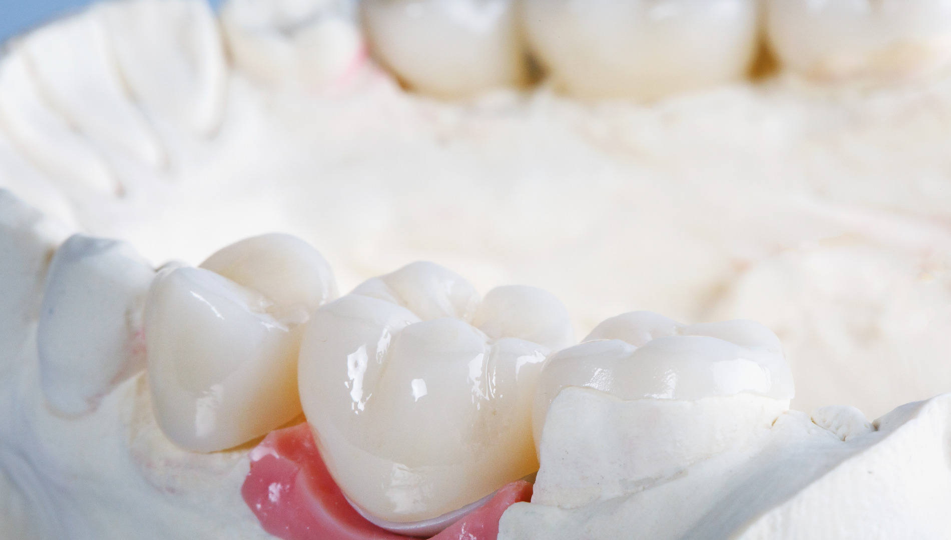 implantology Achieve the perfect smile with our advanced implantology services. Schedule your consultation today!