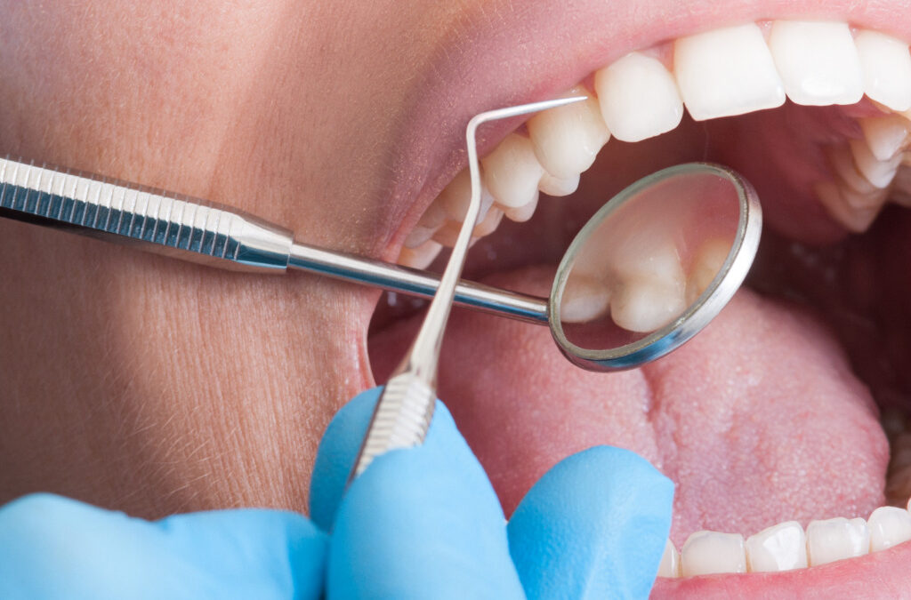 When and Why You Might Need a Periodontist