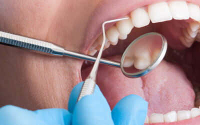 When and Why You Might Need a Periodontist