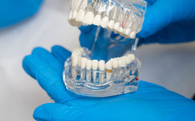Exploring the Latest Technological Innovations in Implantology